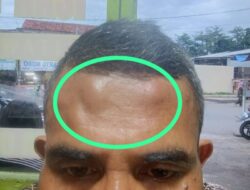 Hasil Penelusuran Miras Ilegal Wartawan Jadi Korban penganiayaan, Pengeroyokan Di Wilayah Kramatwatu Serang Banten.